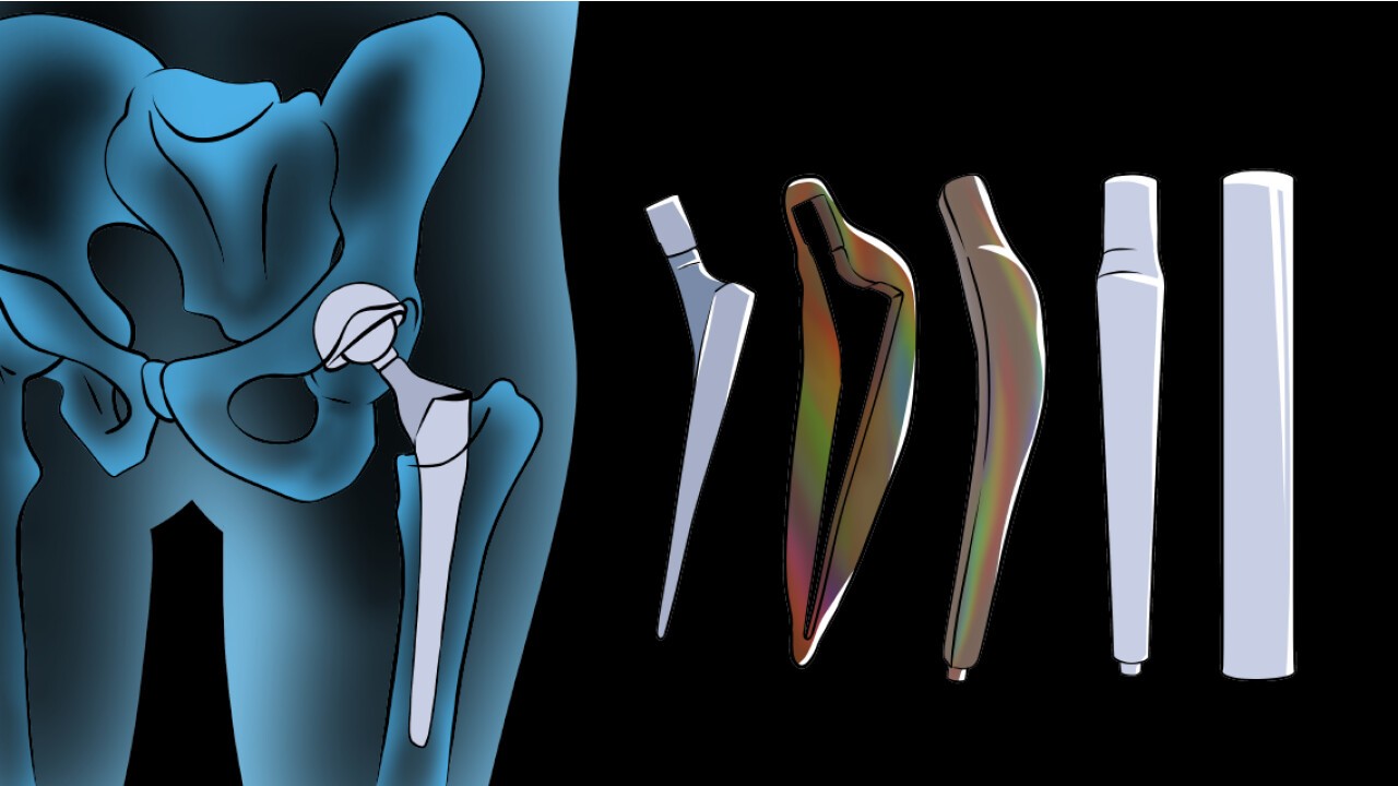 Diameter nach Mass für orthopädische Implantate