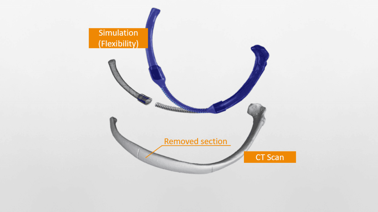 Simulation der Funktionalität des patientenspezifischen Rippenimplantats