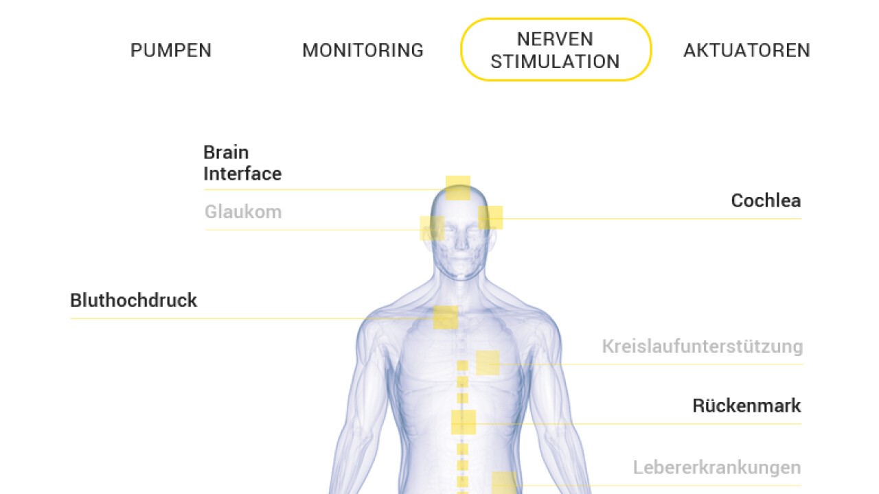 Nerve stimulation