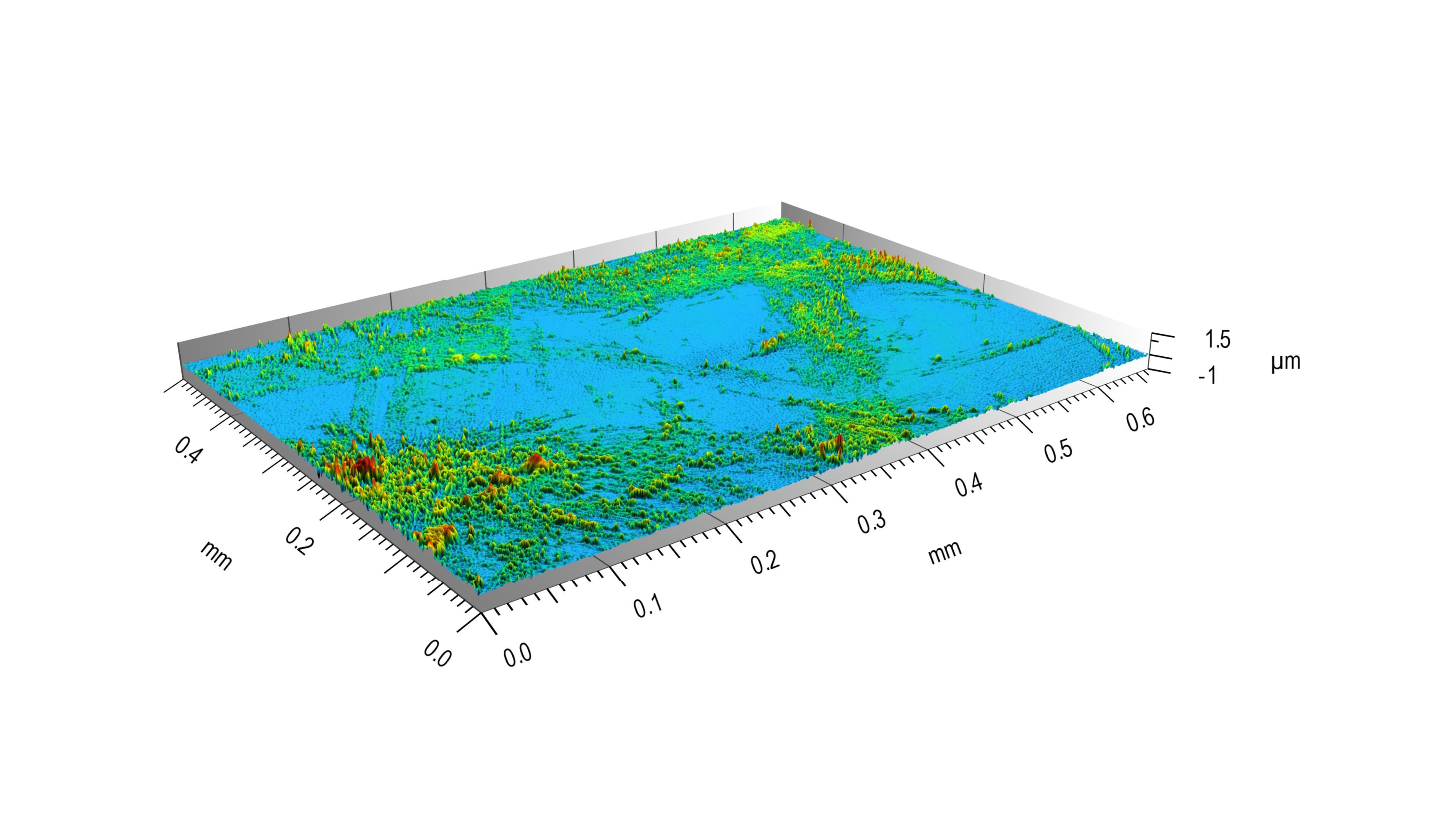 Bild 2: Topographie eines Keramikimplantats: Explantat mit Metallablagerungen